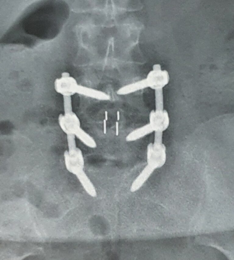 Check Up